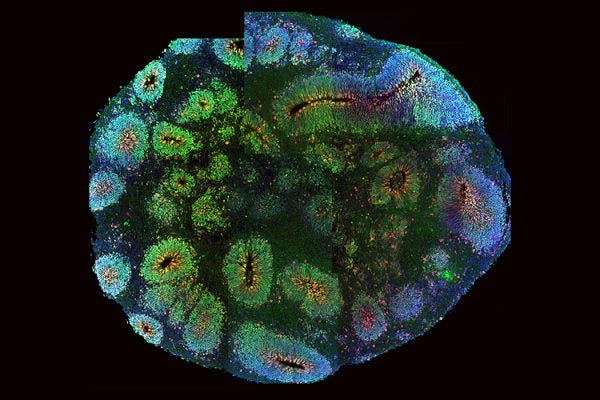 Brain organoid