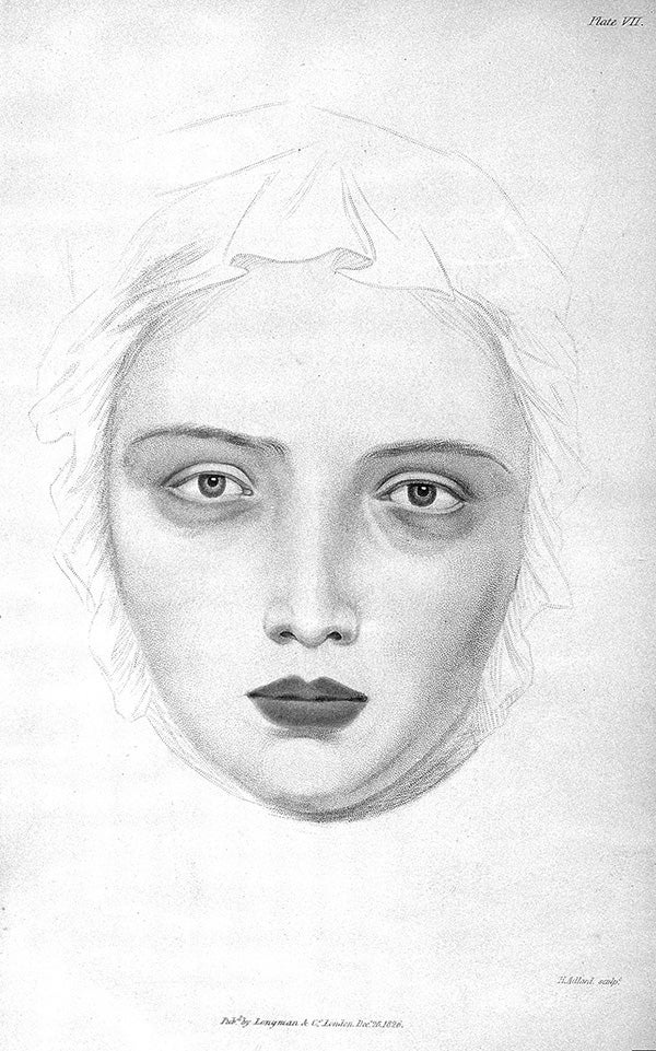 An illustration of chlorosis 